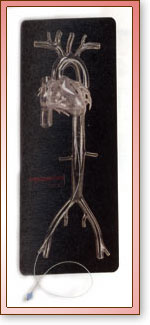 Angiogram Sam