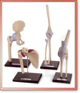 Set de Coyunturas Flexibles