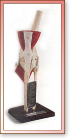 Rodilla de Lujo